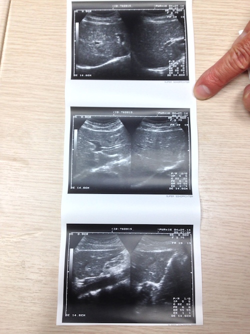 超音波 Ultrasound