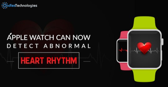 Apple Watch Heart Rhythm