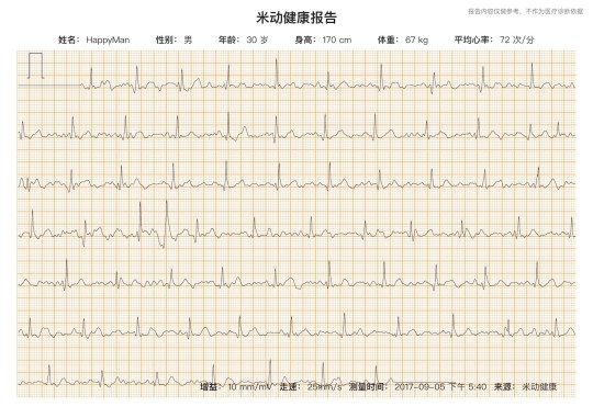 Vera ECG